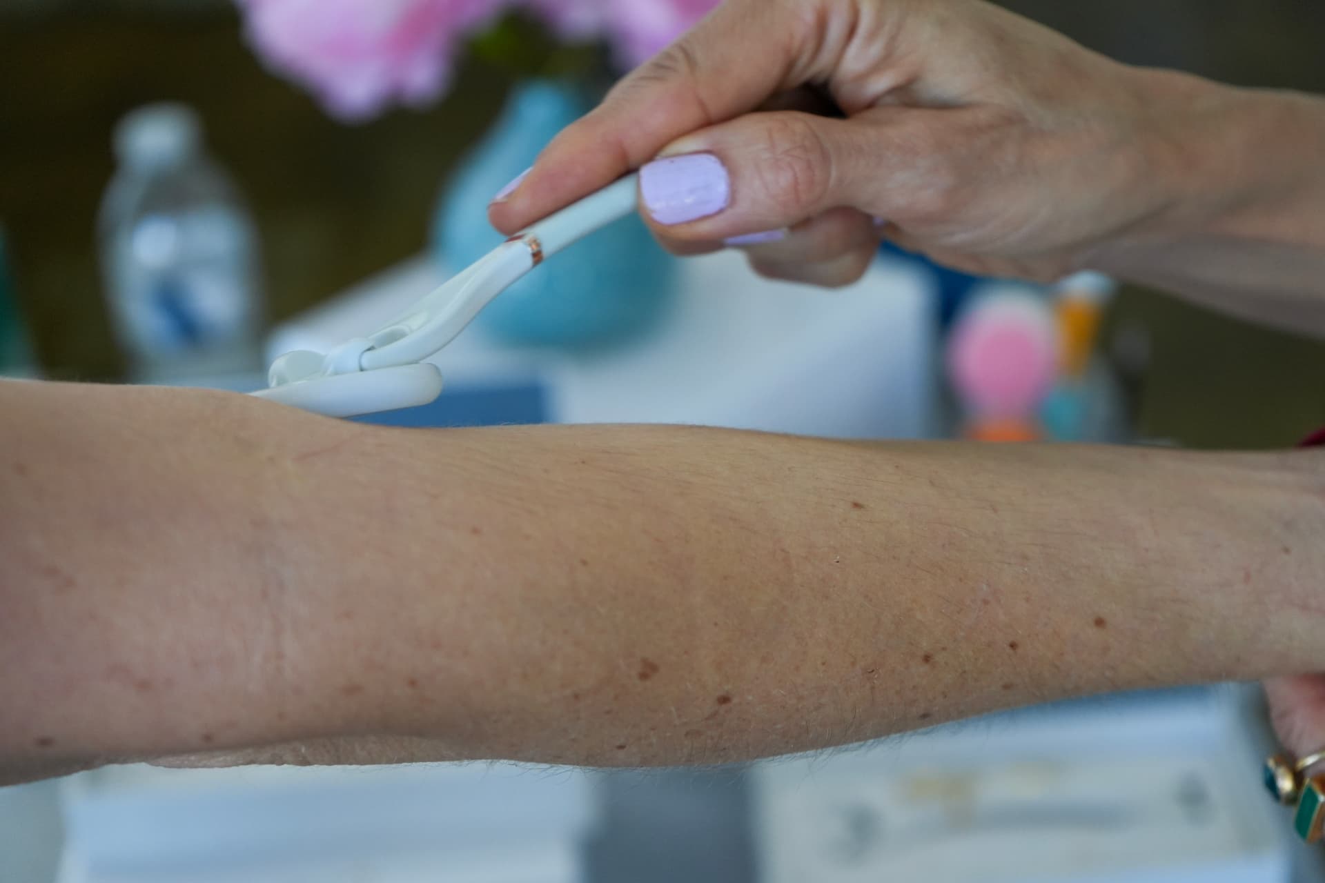 Close-up of a skin treatment tool being demonstrated on an arm